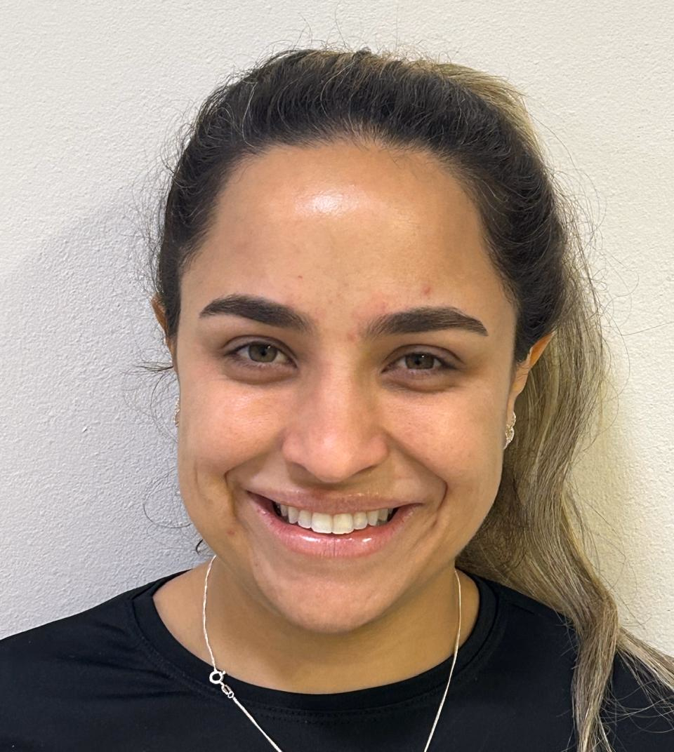 Depois - Harmonização Facial